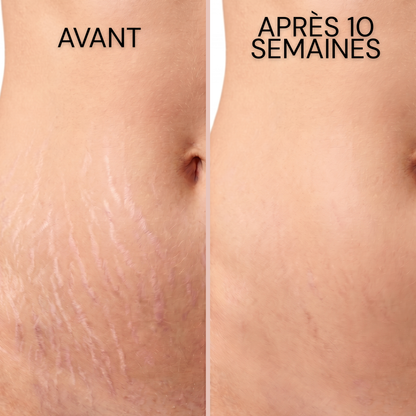 Stick Dermocosmétique pour Cicatrices & Vergetures
